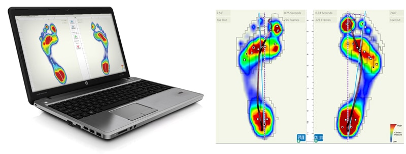 Gaitscan